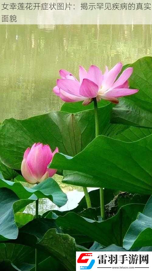 女幸蓮花開(kāi)癥狀圖片