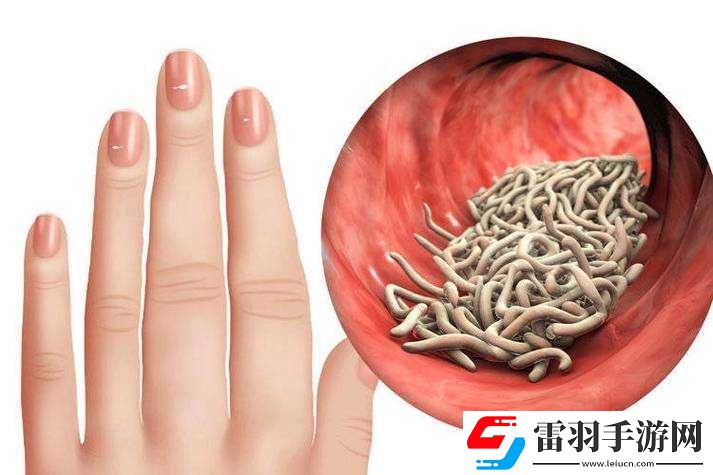 叔叔說(shuō)我體內(nèi)有蟲(chóng)子需進(jìn)一步檢查