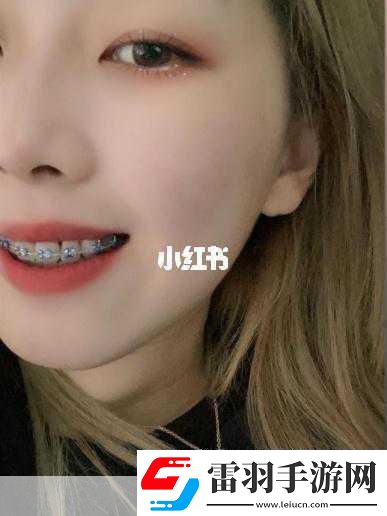 金屬牙套成考場(chǎng)攔路虎玩家熱議人性化缺失