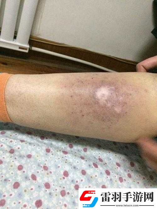淑芬兩腿中間癢得厲害且難受難耐